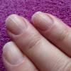 Причины возникновения черных полосок на ногтях